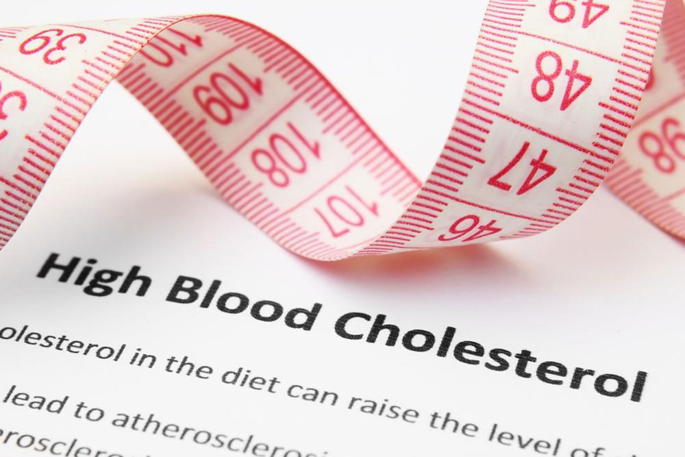 An overview of high cholesterol