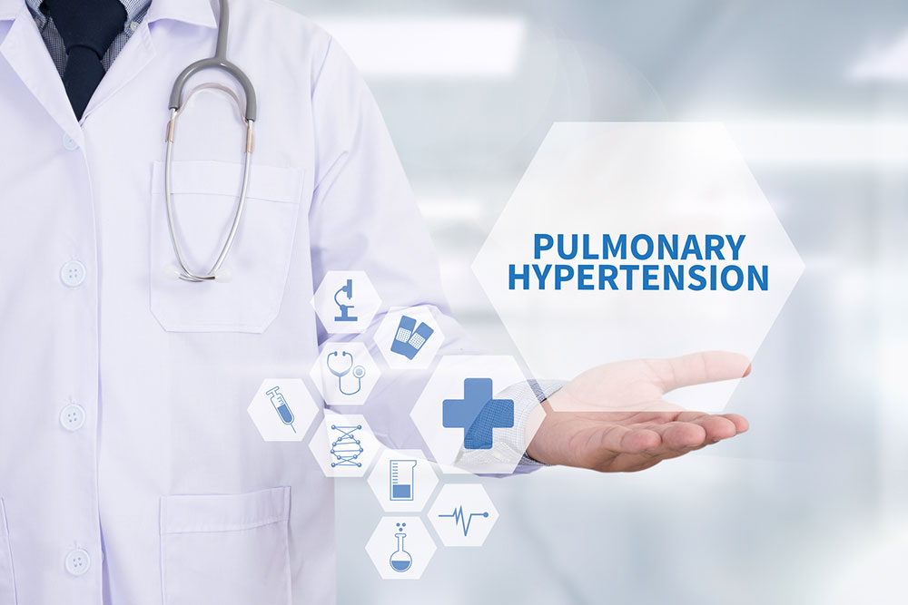 4 things to know about pulmonary hypertension