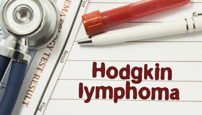 All you need to know about Hodgkin’s disease