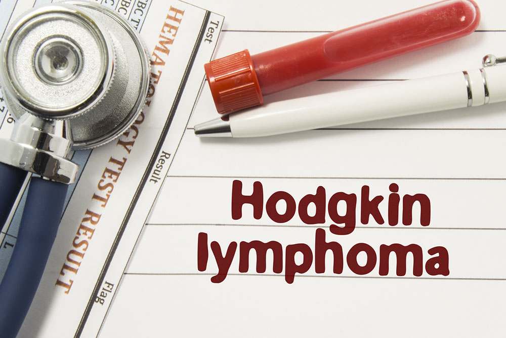 All you need to know about Hodgkin’s disease