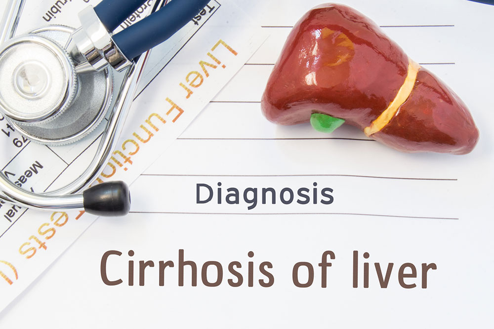 An overview of cirrhosis