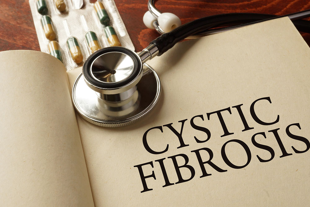 Cystic fibrosis – Symptoms, diagnosis, and treatment