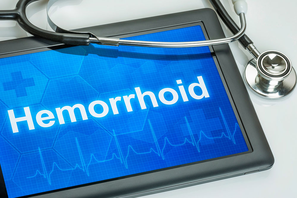 How to cope with Hemorrhoids during pregnancy