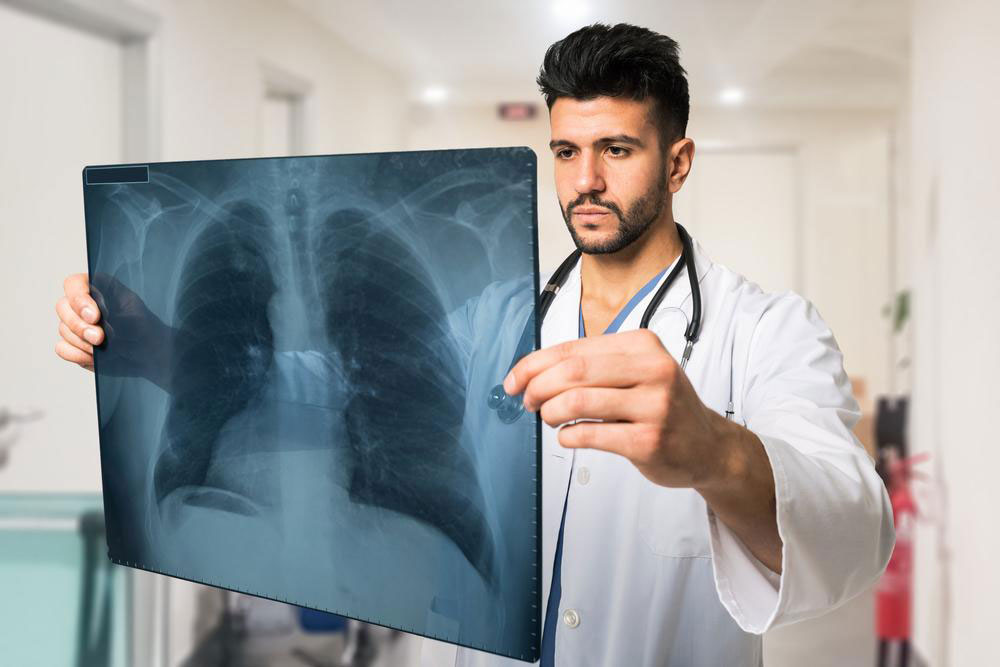 Non-Small Lung Cancer Treatment Options
