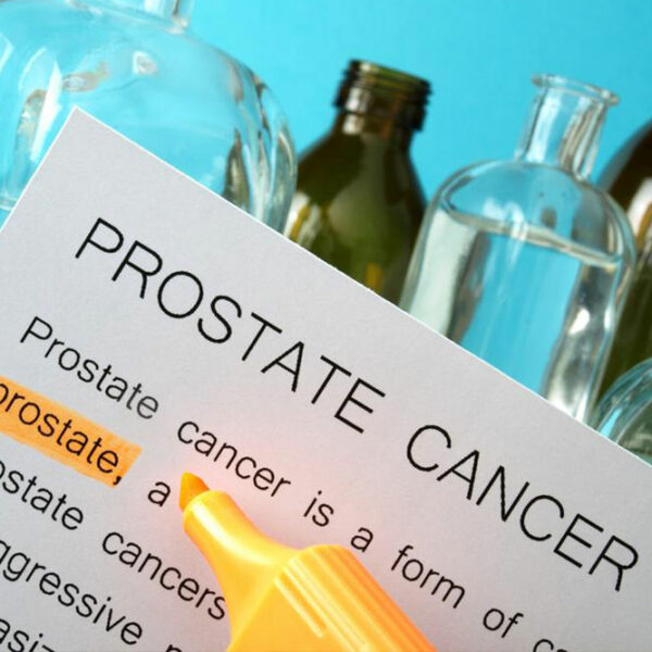 Prostate cancer- An overview