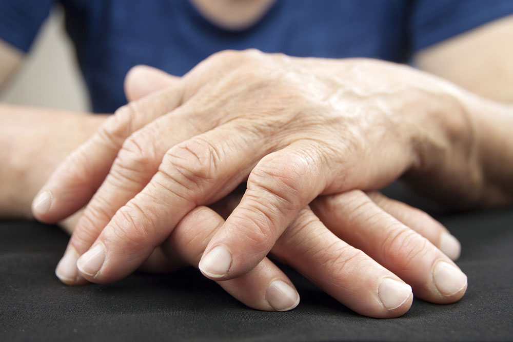Top treatment plans for rheumatoid arthritis