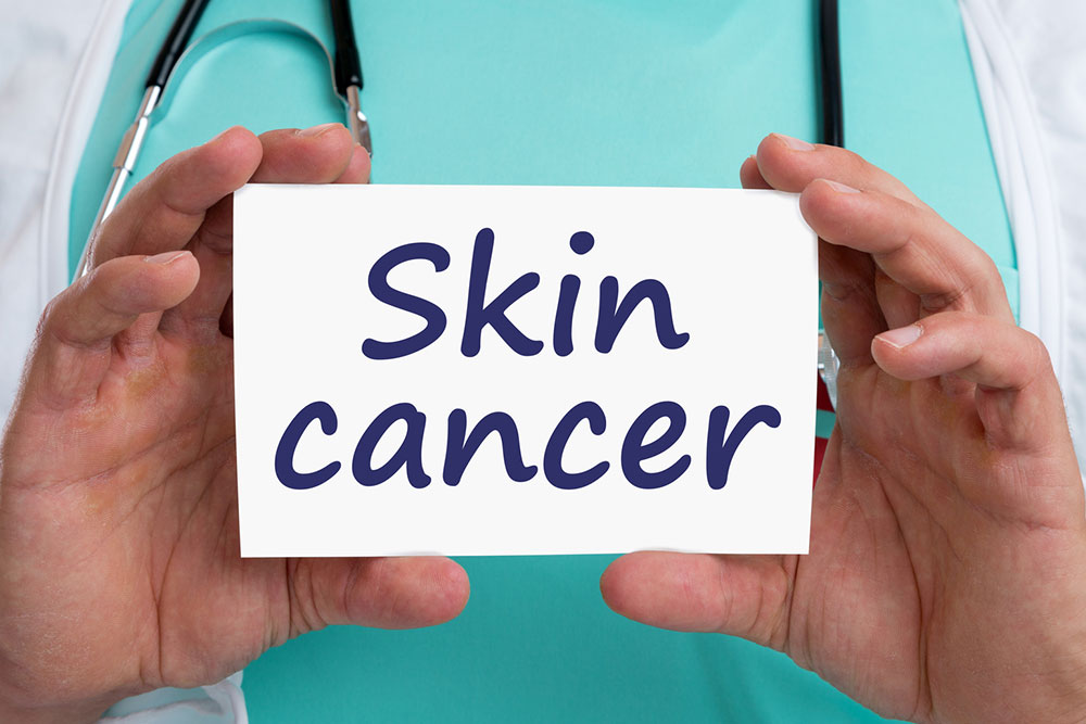 Understanding the types of skin cancer
