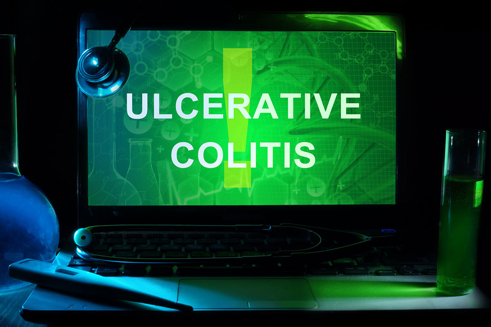 What you should know about ulcerative colitis